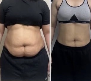 Client progress photos, gallery image 17